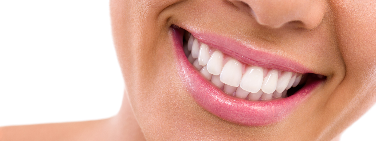 KöR® Teeth Whitening